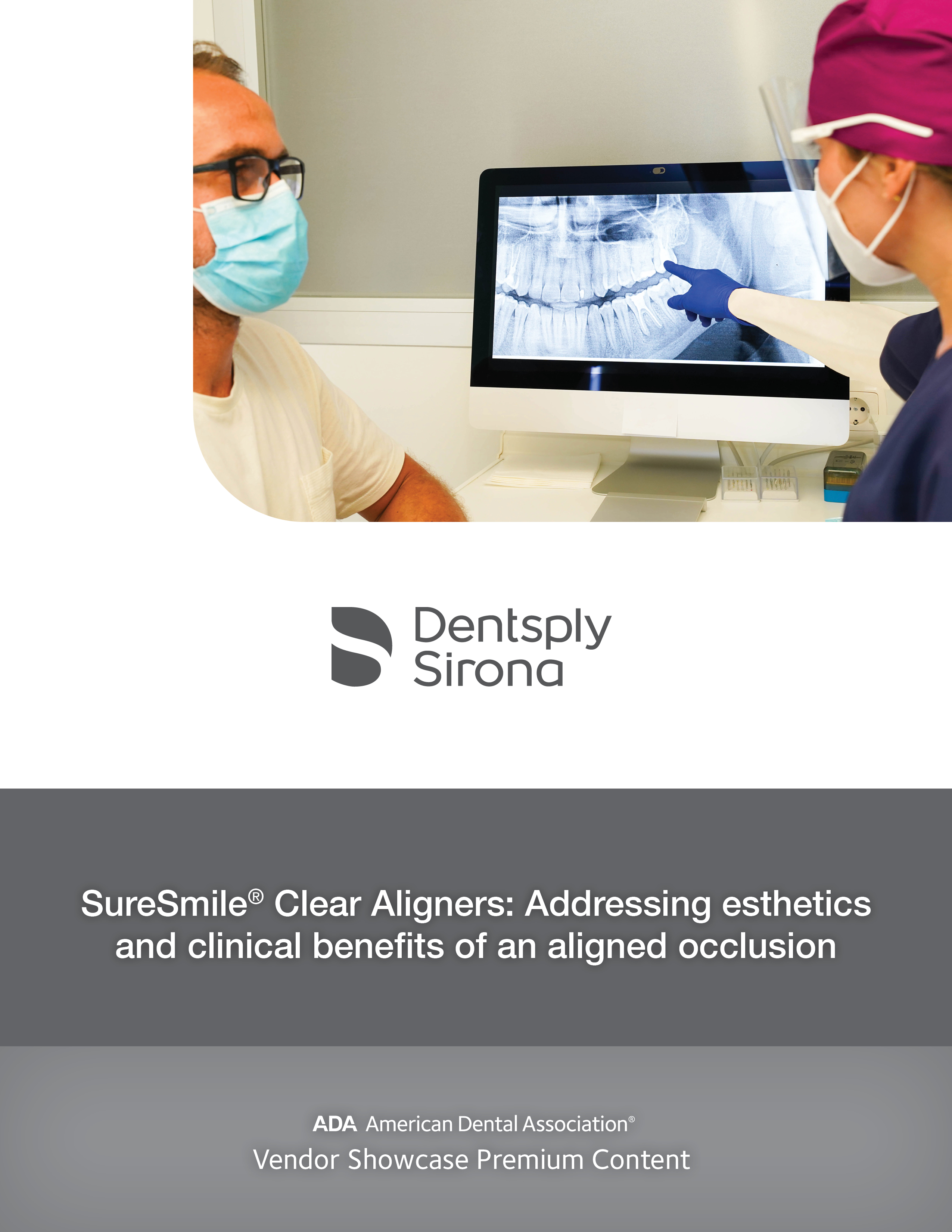 SureSmile® Clear Aligners: Addressing esthetics and clinical benefits of an aligned occlusion
