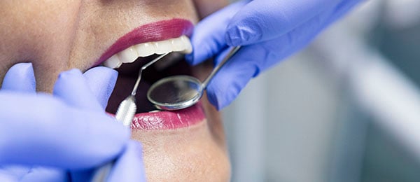 Restorative therapies for root caries