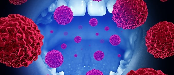 graphic image of a mouth with floating cancer cells