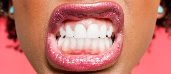 Woman showing her teeth