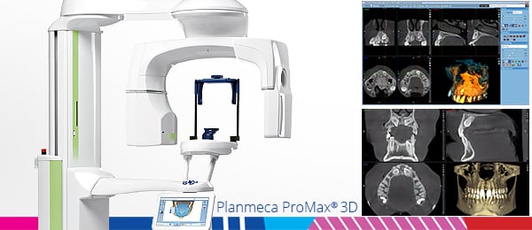 Planmeca Viso CBT imaging system