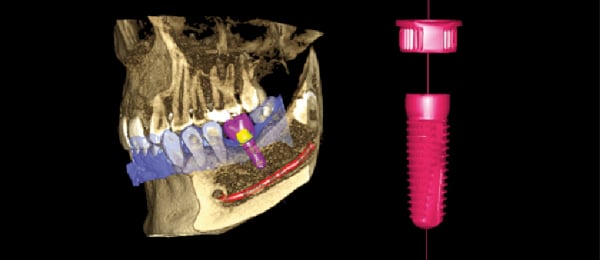 Planmeca cone-beam computed tomography images