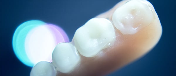 Photo of partial denture