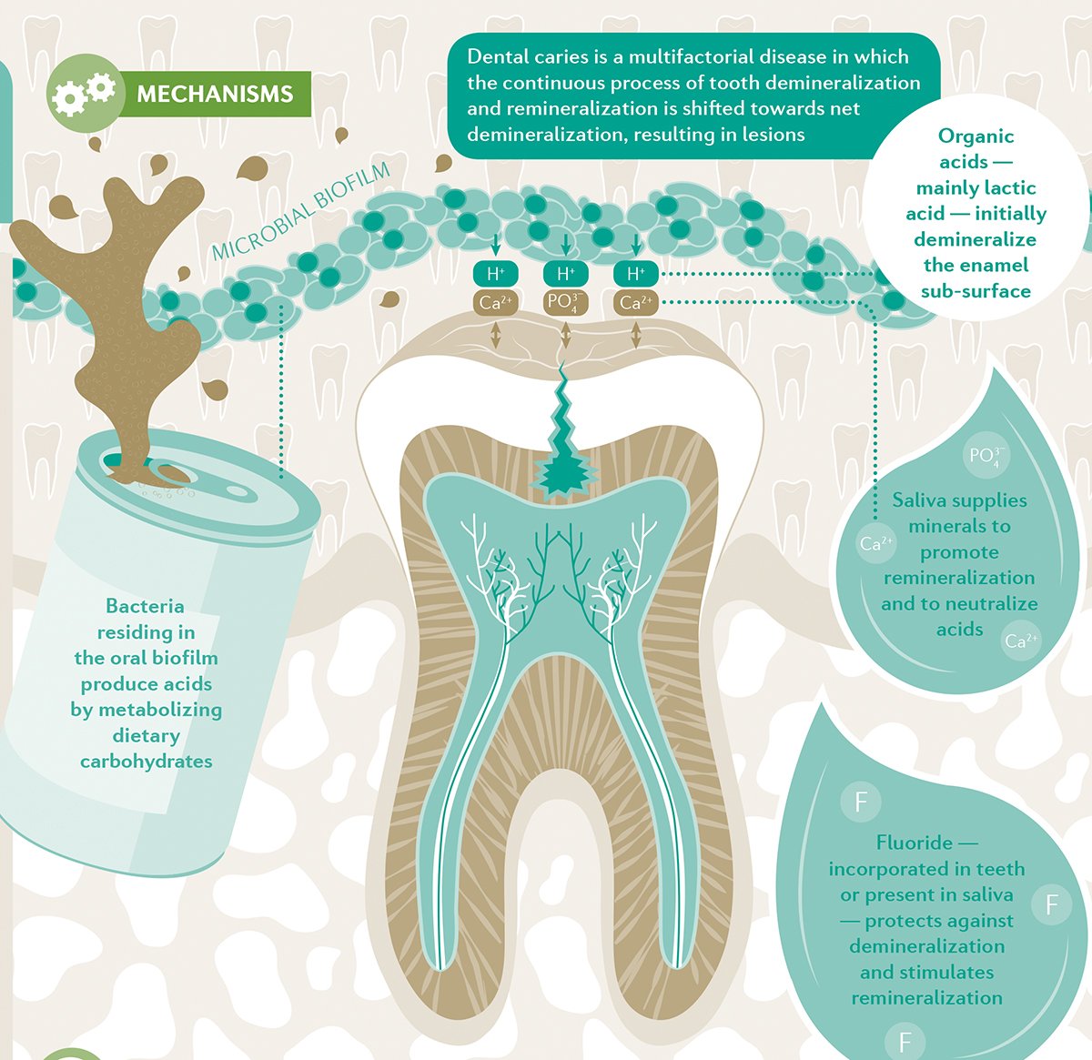 Caries Overview 2021: Epidemiology, Etiology, and Evidence-Into-Action ...