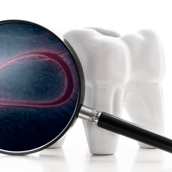 tooth with magnifying glass showing disease